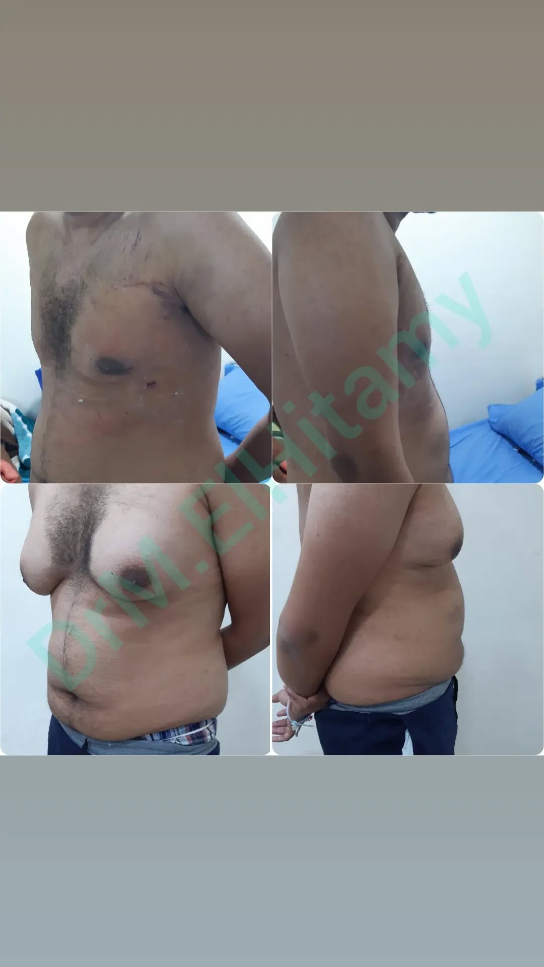 الصفحة الرئيسية 98 274729708_1343712999464222_5308286696684602633_n..webp