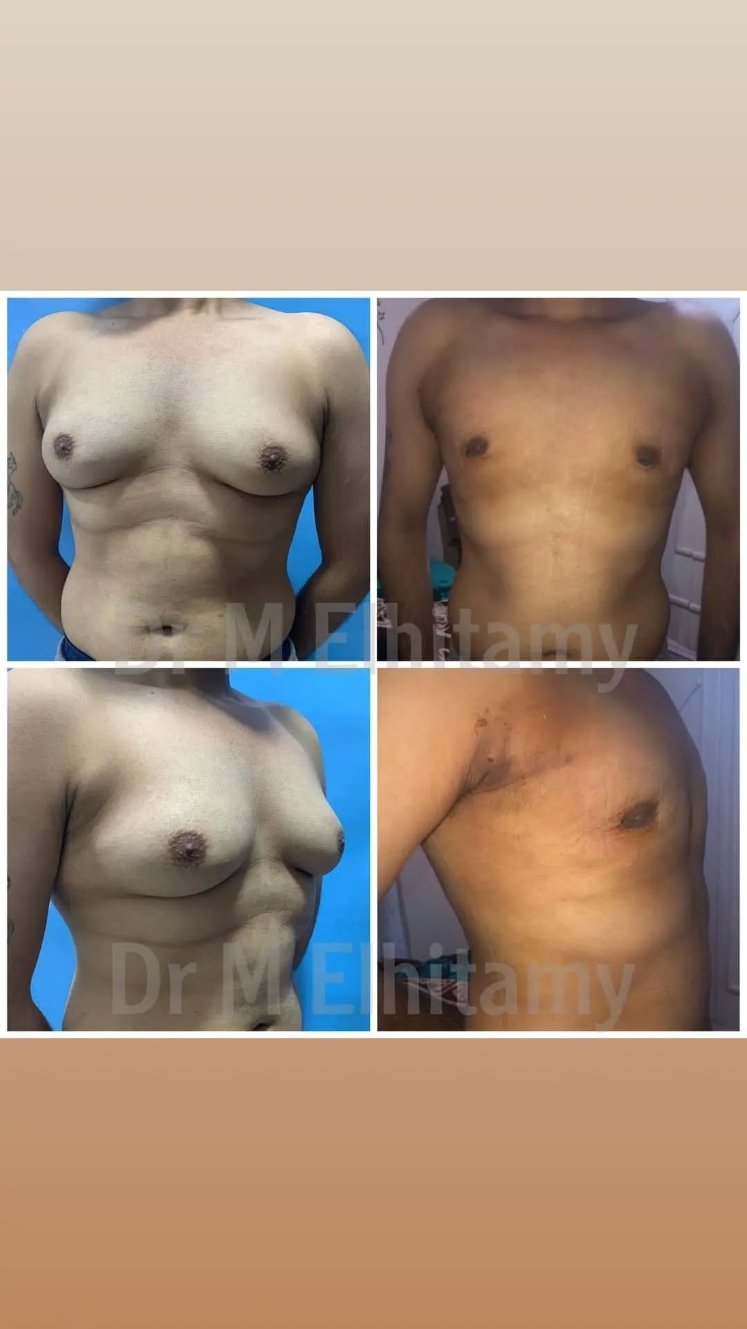 الصفحة الرئيسية 81 274743235_136706008848011_1885385936479285671_n..webp