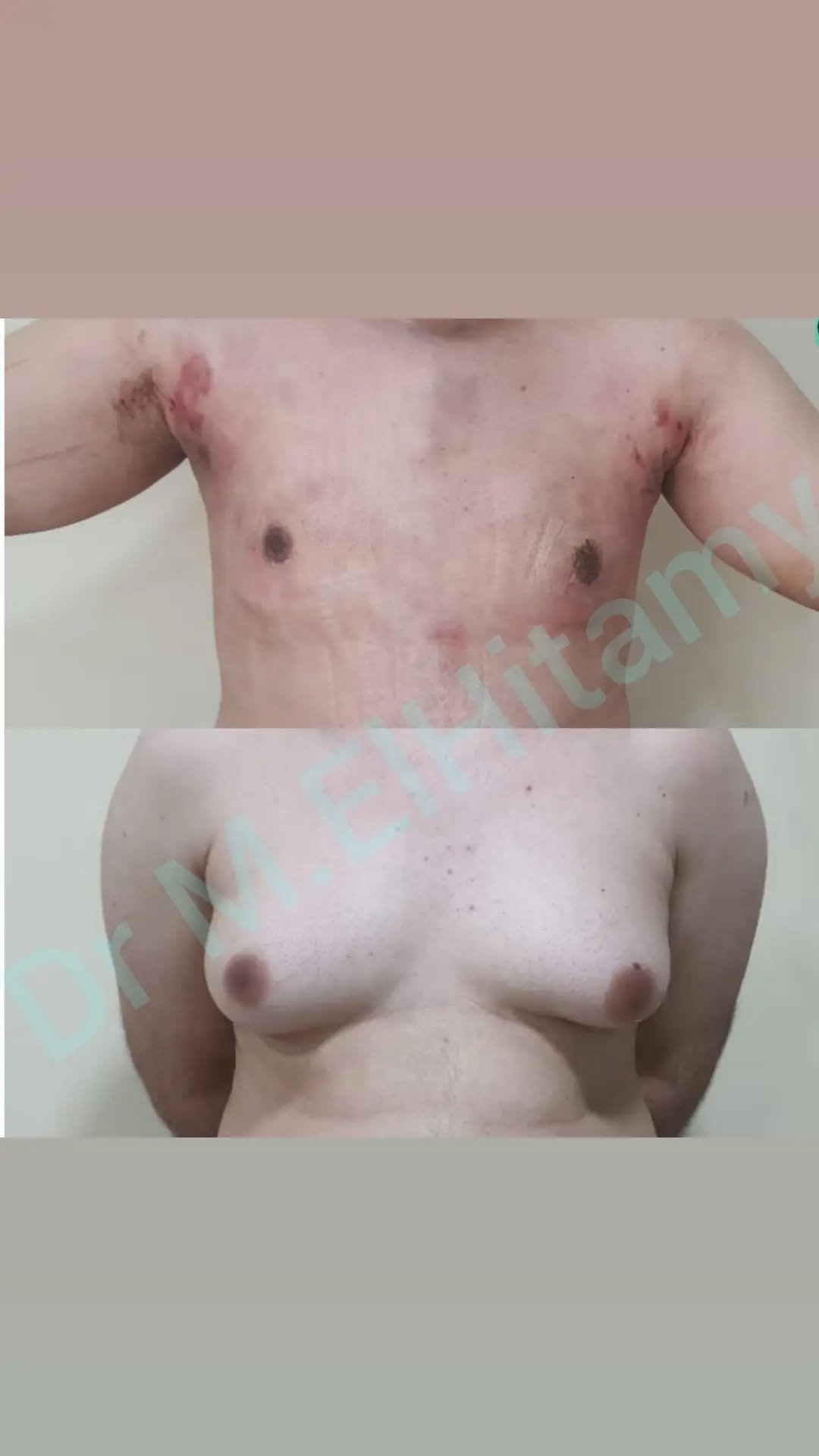 الصفحة الرئيسية 80 274748462_321815606591096_706984458108408862_n..webp