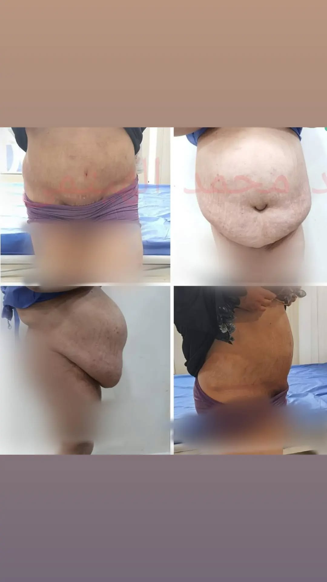 الصفحة الرئيسية 19 274805413_471289828064715_9109599343832444951_n..webp