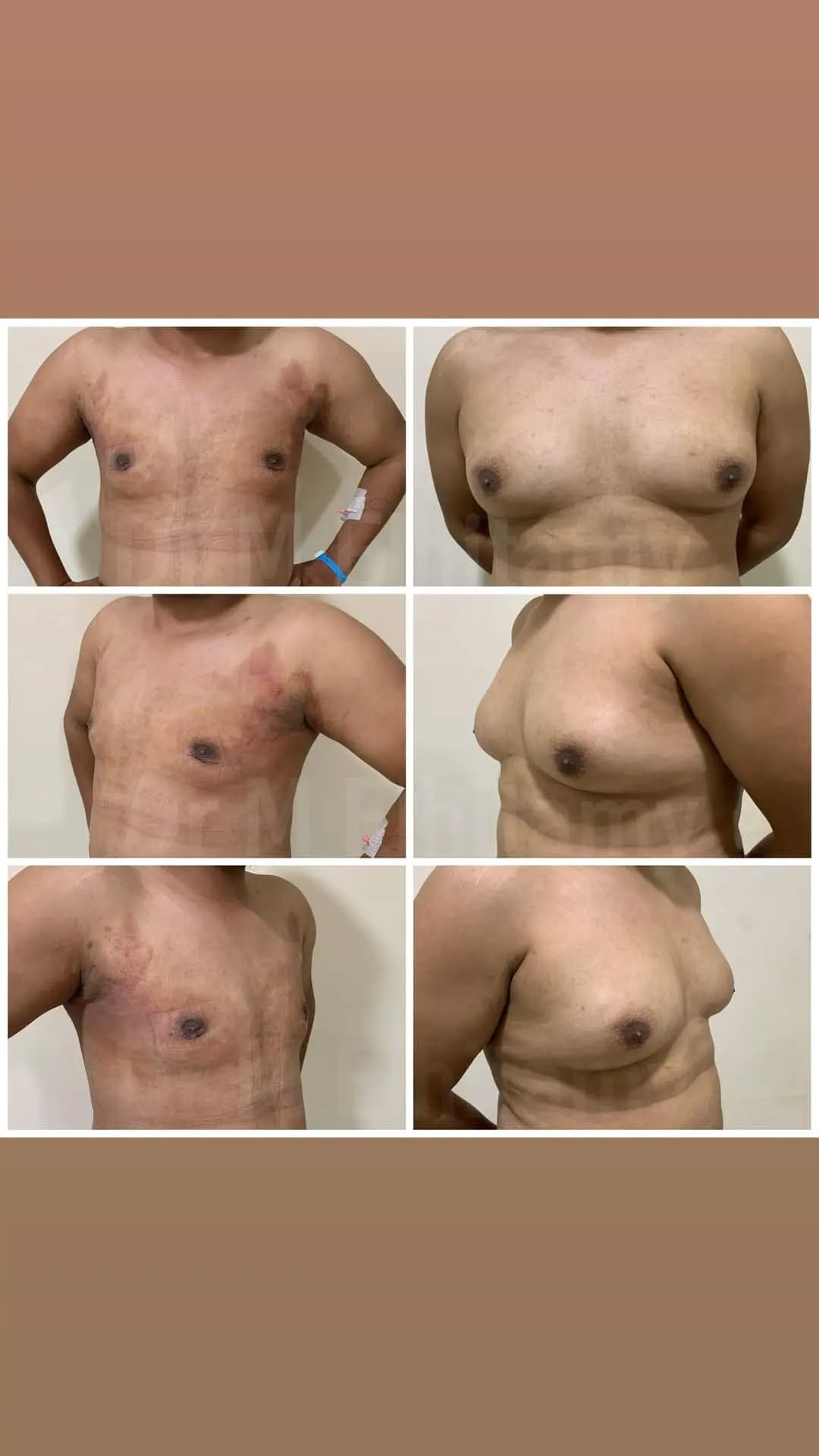 الصفحة الرئيسية 82 274808948_363286278917818_2330723971343184778_n..webp