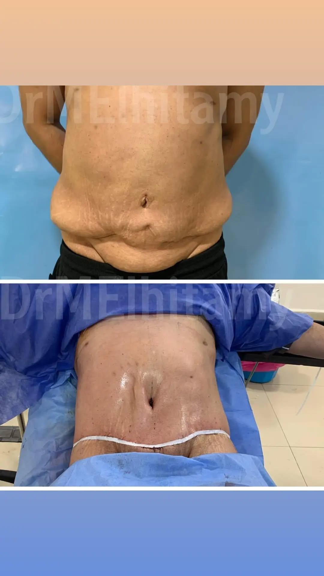 الصفحة الرئيسية 20 274887580_116598004284449_3208017701971303693_n..webp