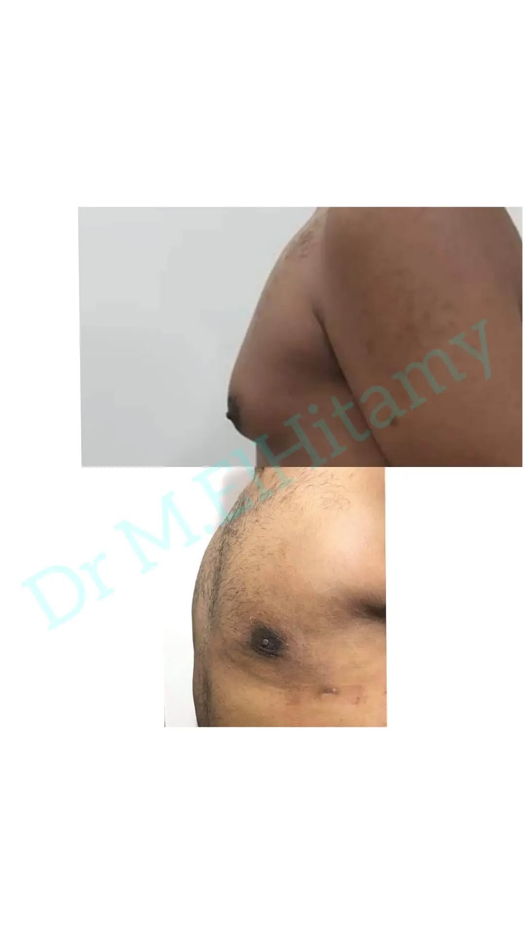 الصفحة الرئيسية 86 275003276_635755190869510_8647228958225422344_n..webp