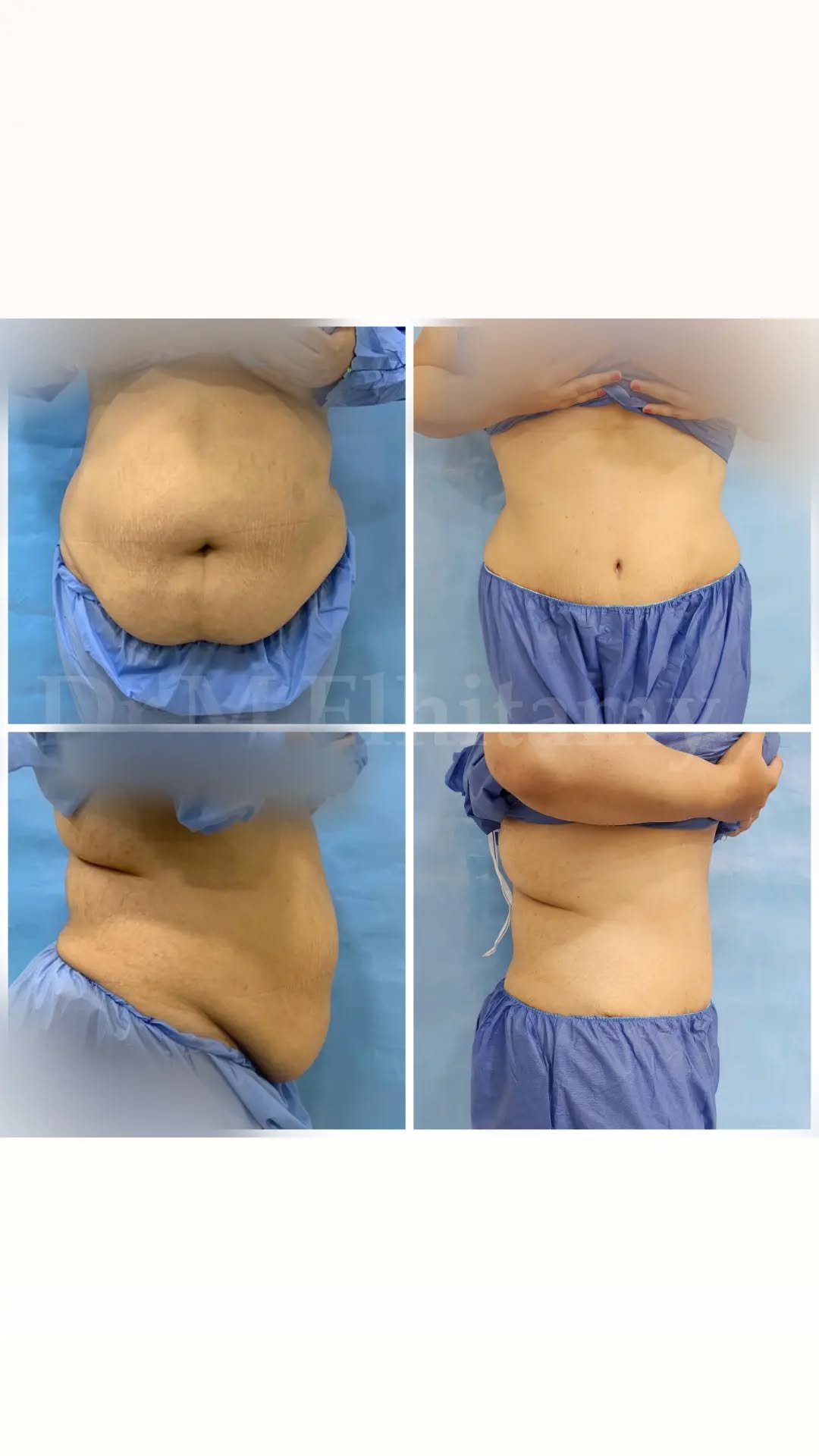 الصفحة الرئيسية 26 309012082_367027345548793_540140410844910976_n..webp