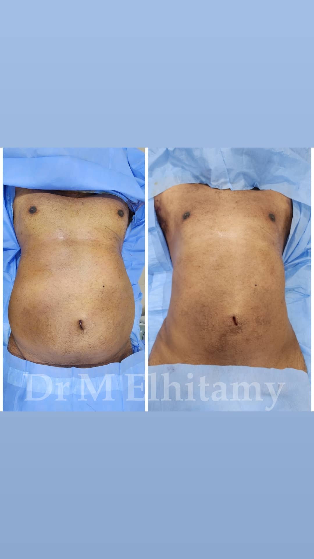 الصفحة الرئيسية 107 310971723_5494796160589757_2895139044818298391_n.