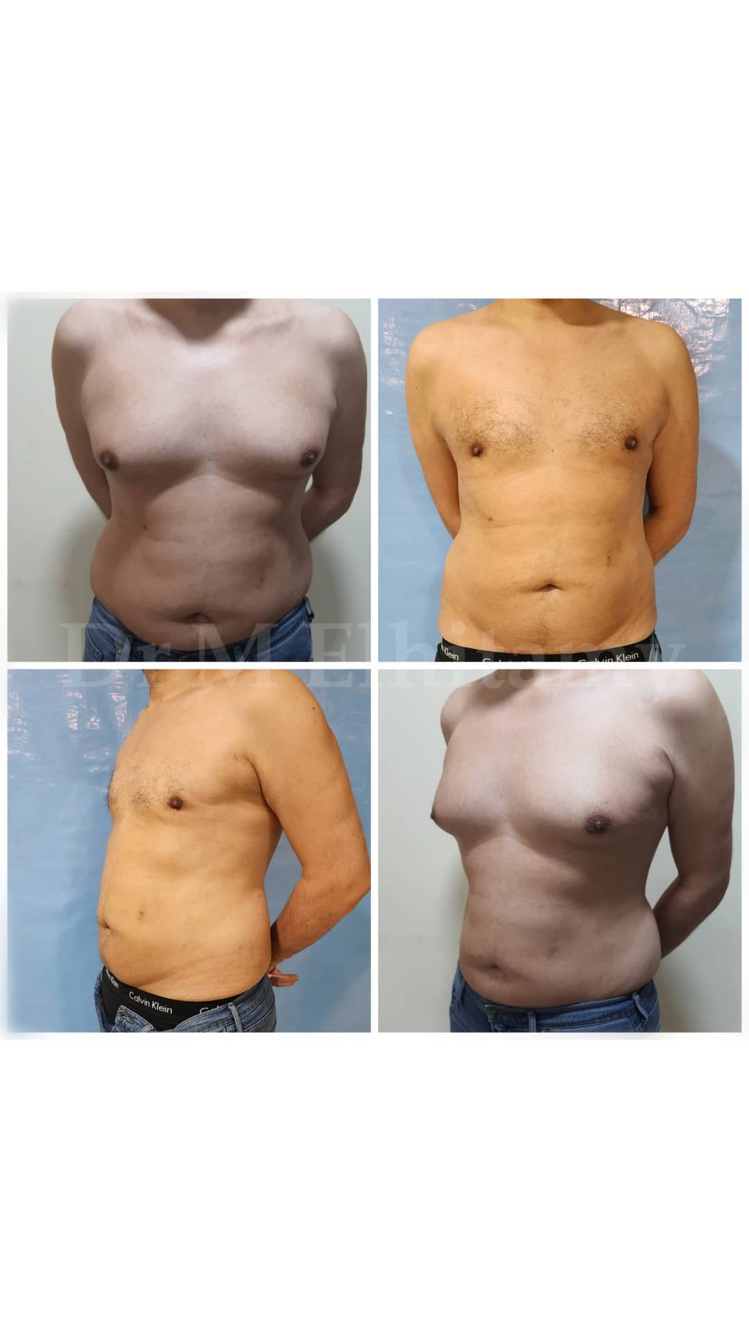 الصفحة الرئيسية 106 311372797_1444470866034634_5692386305207422331_n.