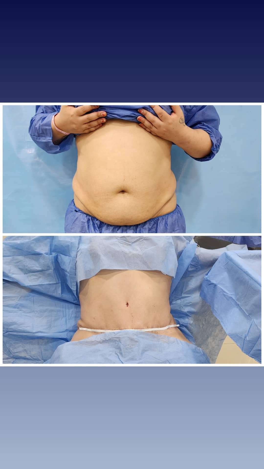 الصفحة الرئيسية 24 311921949_835225130947017_5188918045019653560_n.