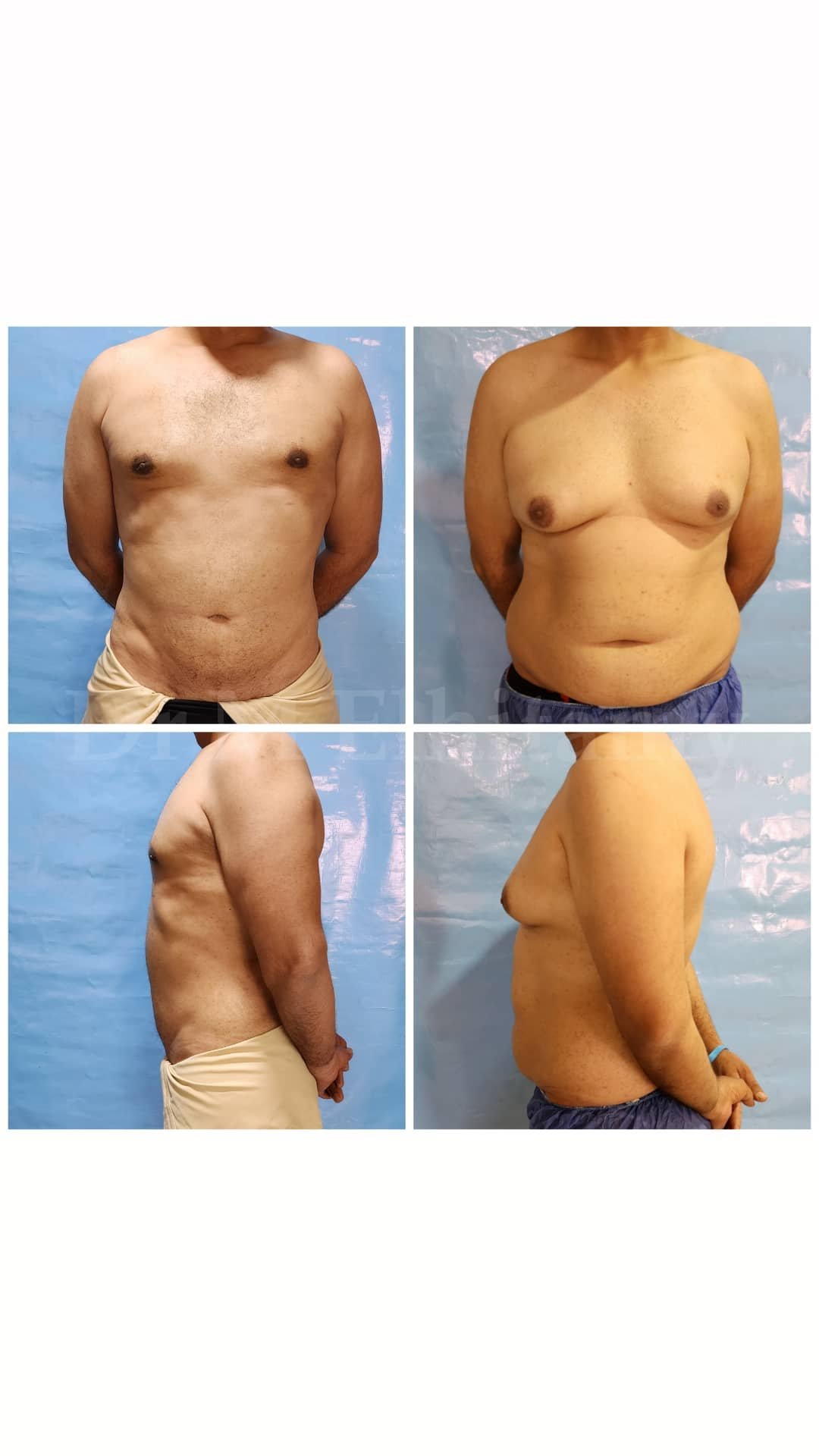 الصفحة الرئيسية 105 313872798_1085386852145095_7931962861717203927_n.