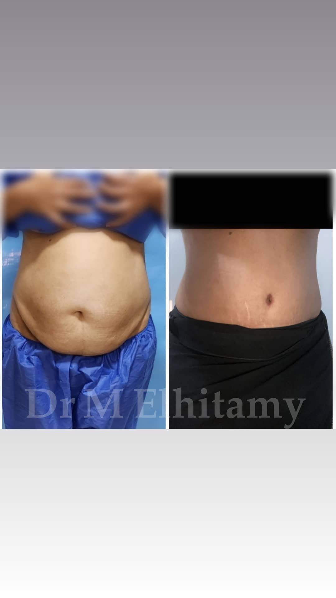 الصفحة الرئيسية 27 316889220_621197263137396_5796543177278193777_n.