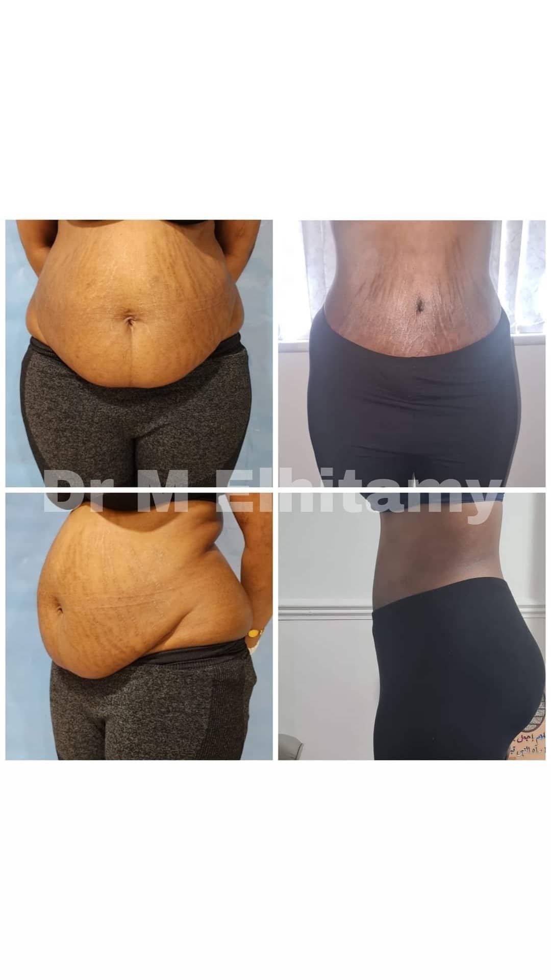 الصفحة الرئيسية 30 325310668_141725082040551_4361870656666352961_n.