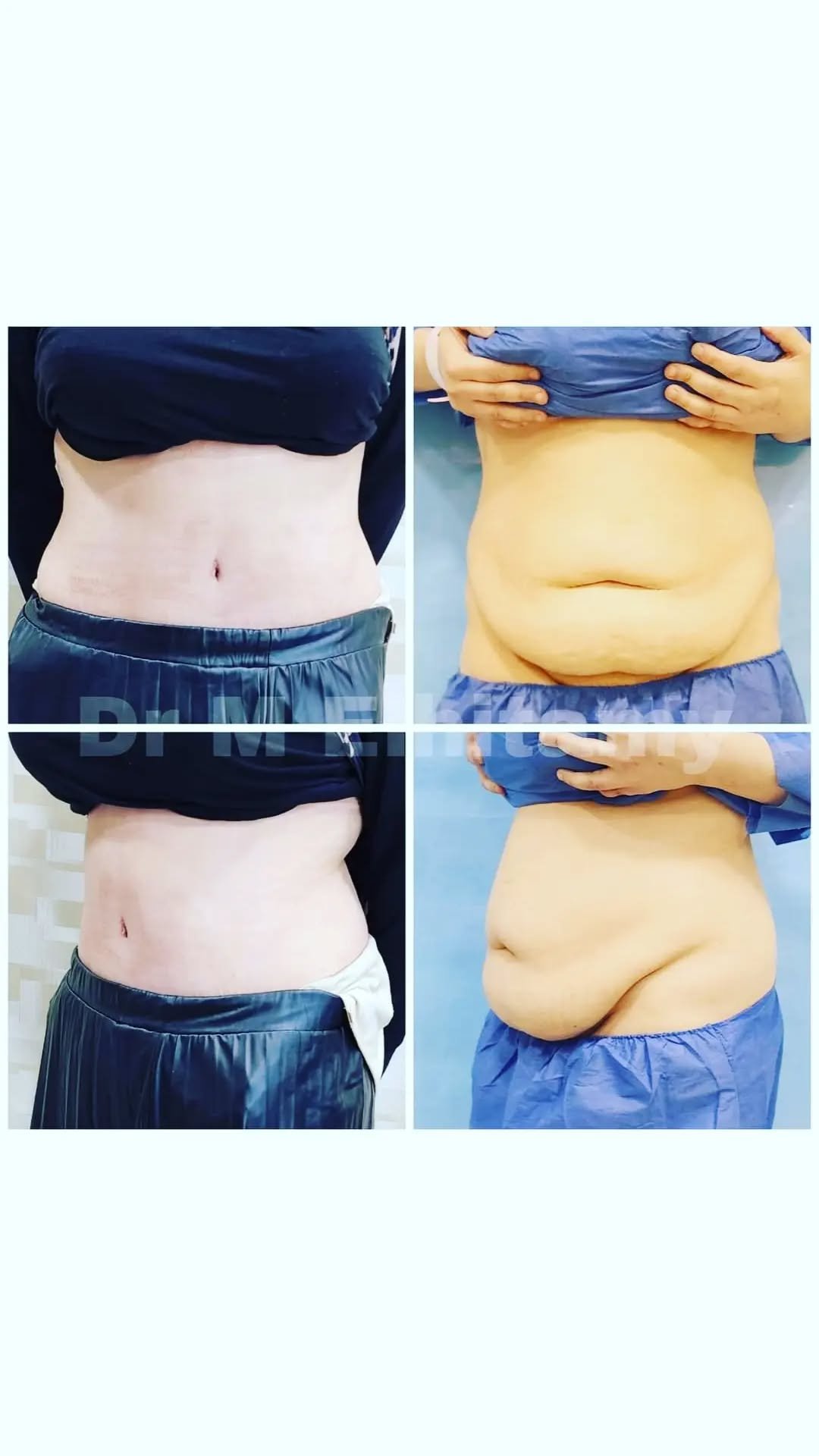 الصفحة الرئيسية 37 338429874_241915084879995_8545183692314254753_n..webp