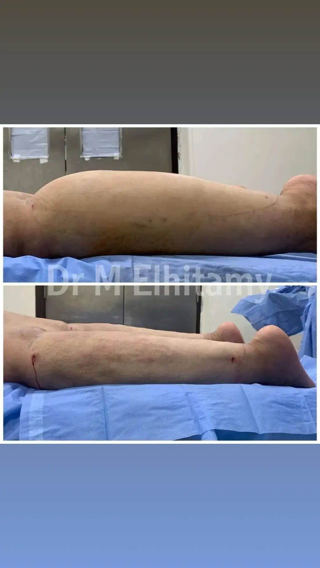 الصفحة الرئيسية 71 338941945_907097257222045_2626456121805205472_n.webp