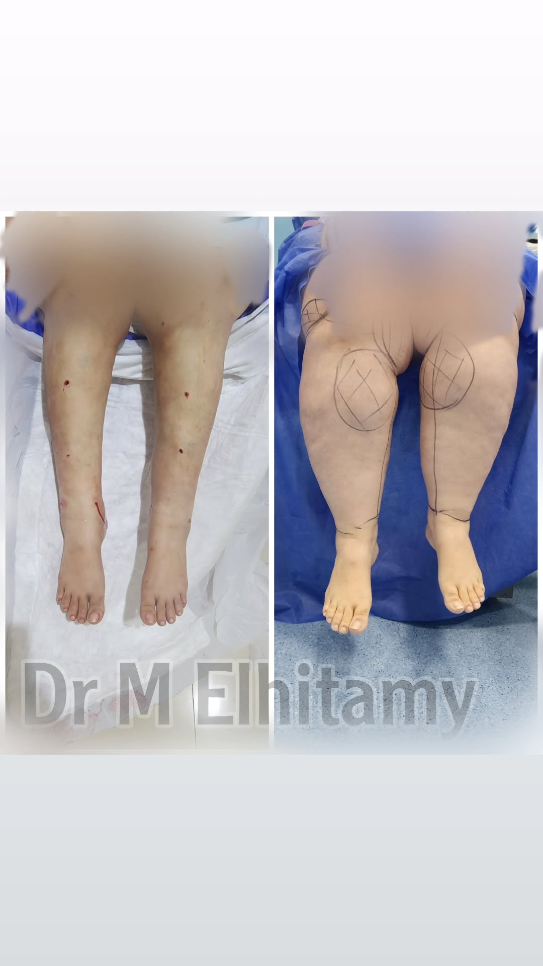 الصفحة الرئيسية 77 461690253_895299139228434_5308760592273345360_n.heic