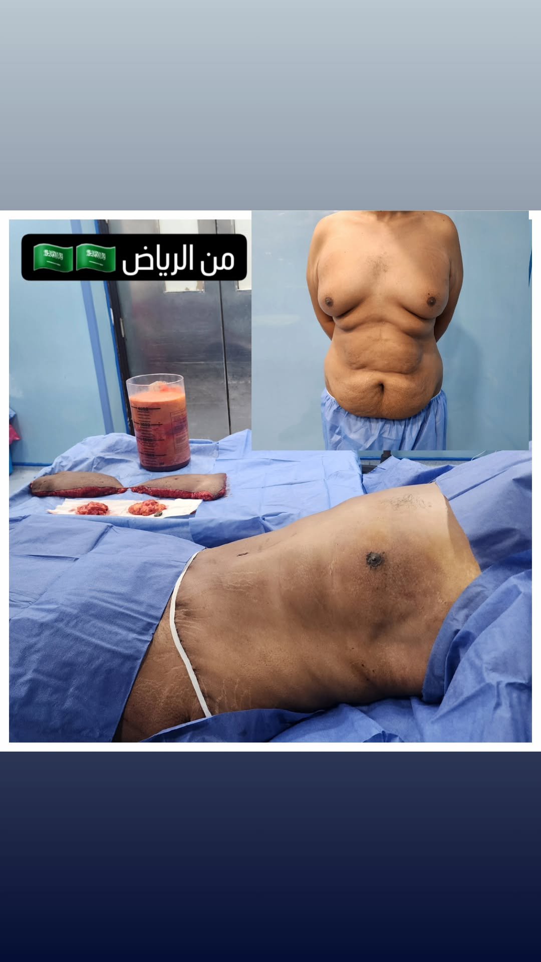 الصفحة الرئيسية 35 467543671_568656835649132_6196570374053170713_n..heic