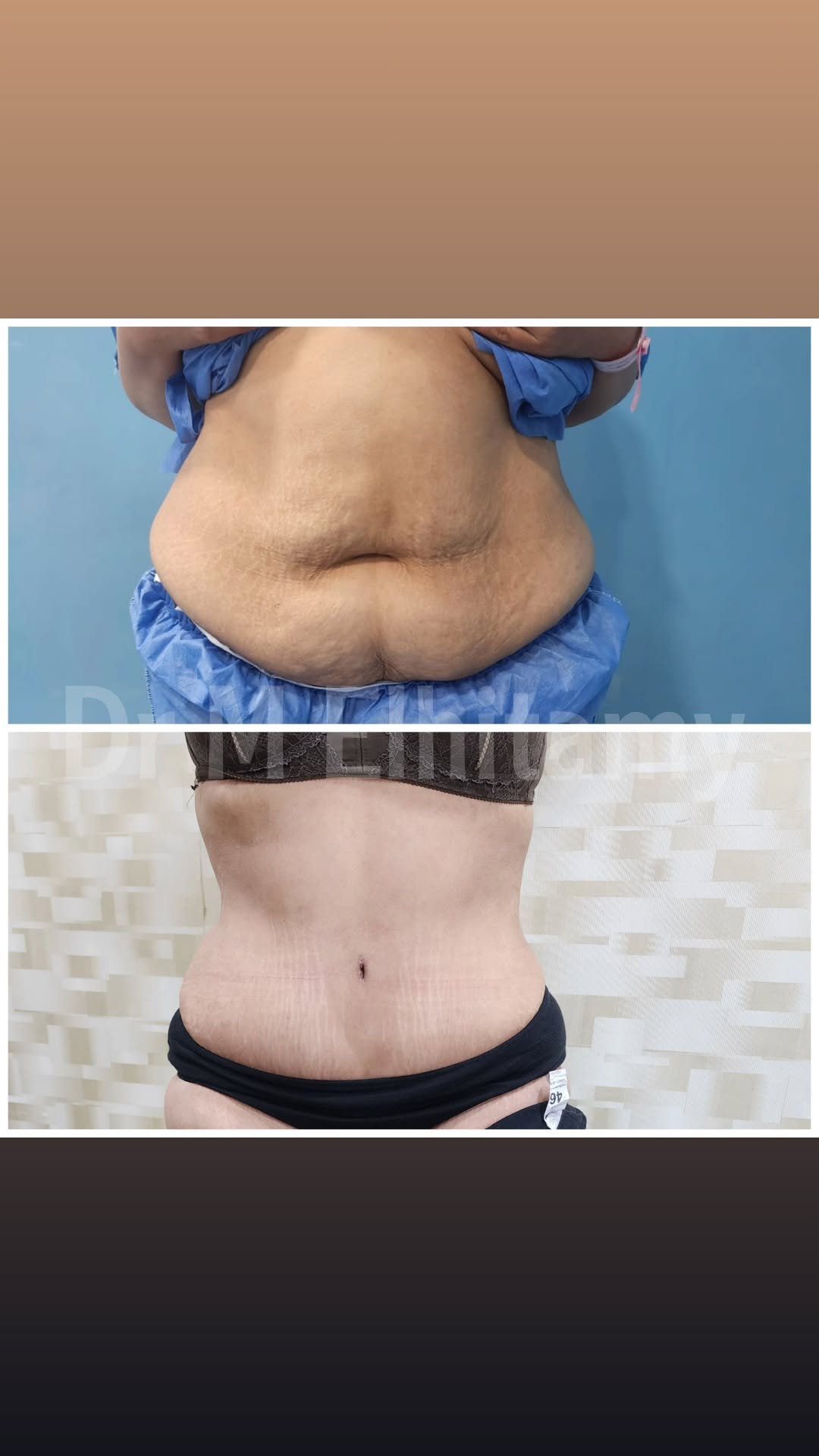 الصفحة الرئيسية 33 470899126_1094820088636152_182224007708749062_n..heic