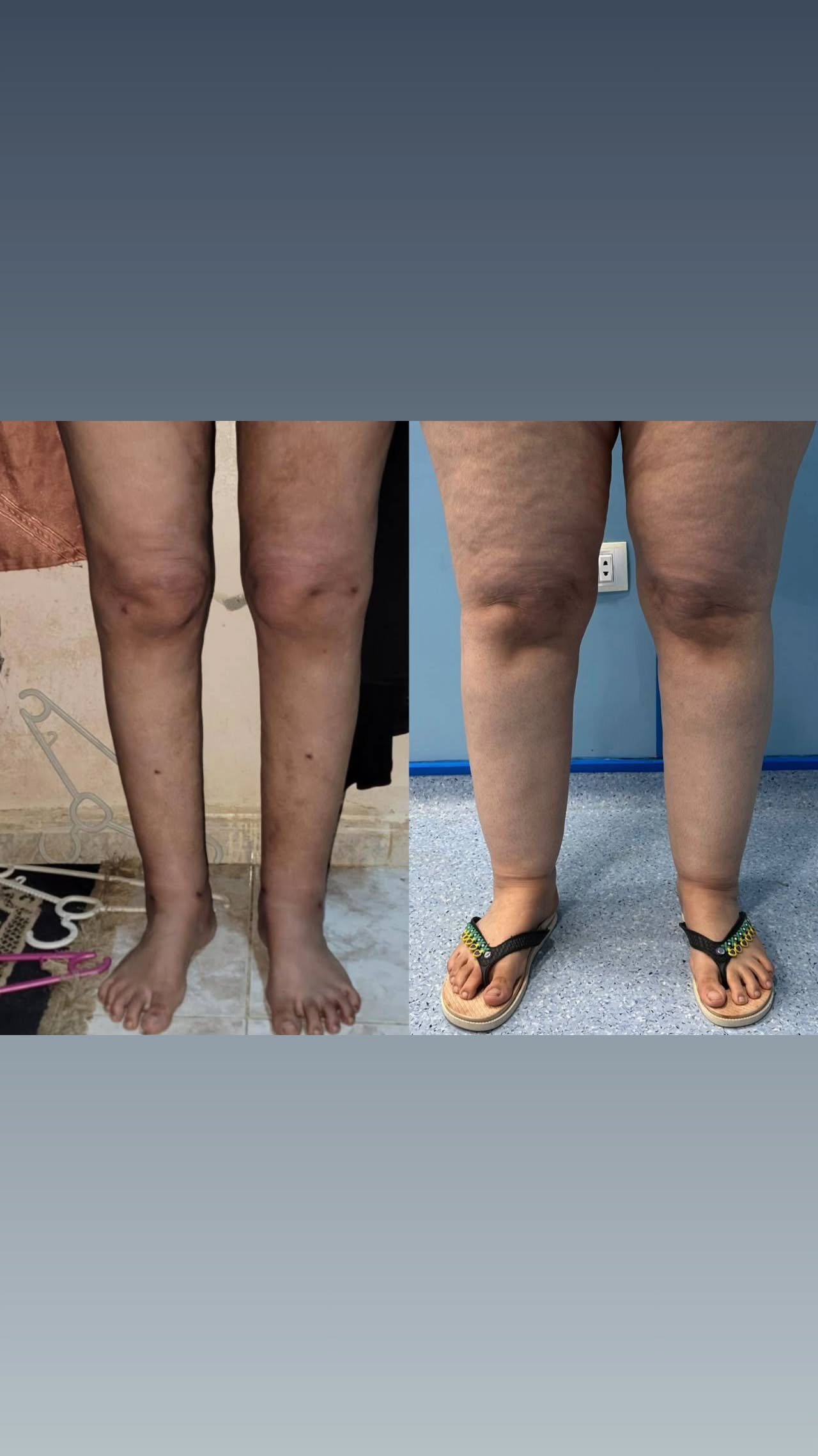 الصفحة الرئيسية 75 472634185_2021794341667397_3951063995822525091_n.heic (1)