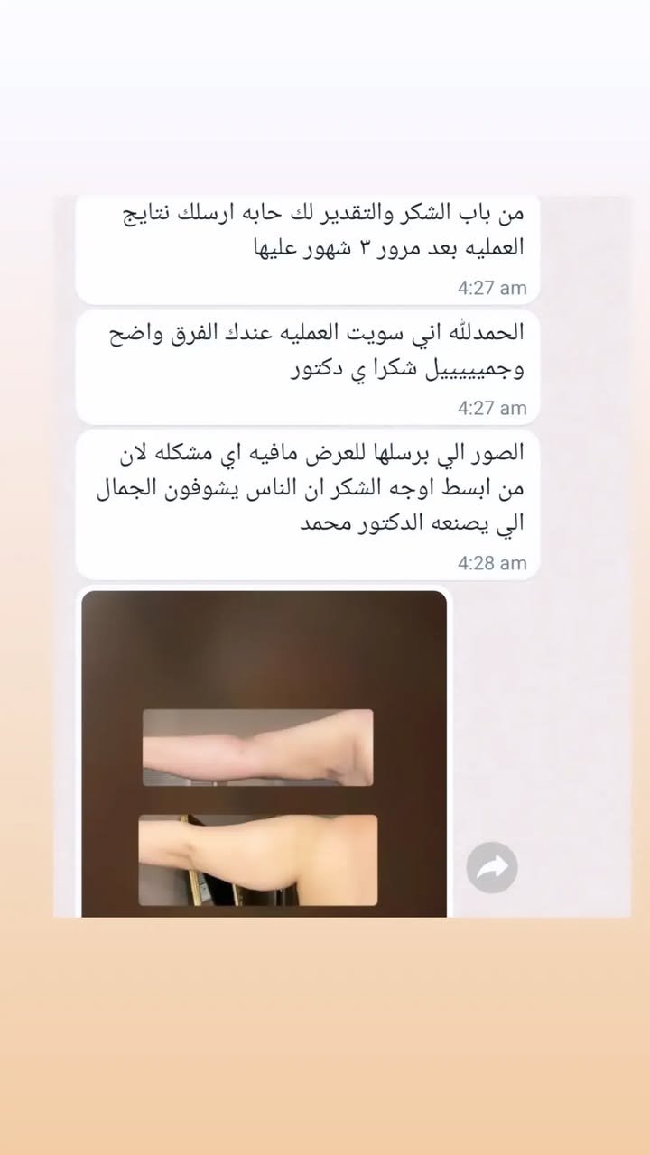 الصفحة الرئيسية 44 332761875_494801429526624_6506700402867815216_n.webp